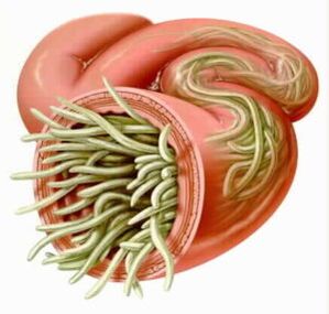 Parasites in the intestine