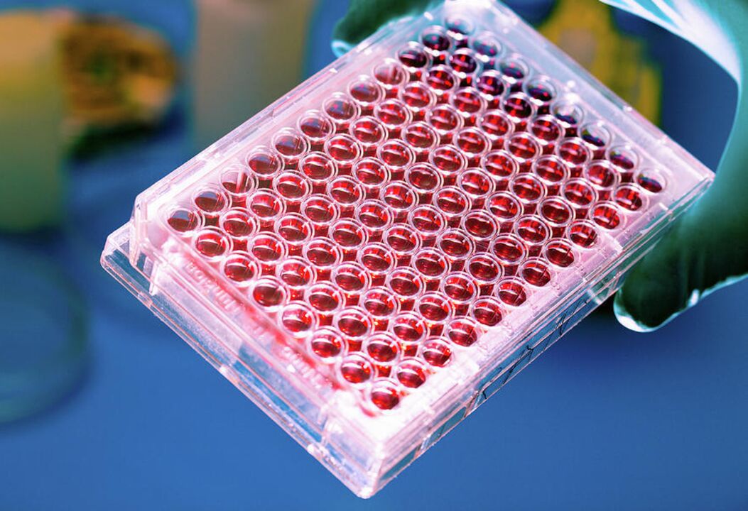 Blood test for parasites