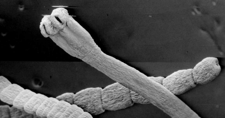 Worms from the human body