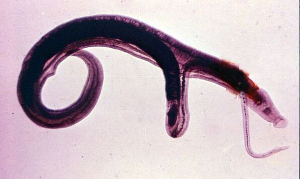 Schistosomes are among the most common and dangerous parasites